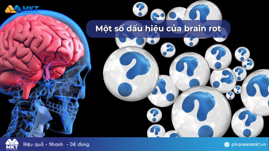 Một số dấu hiệu của brain rot