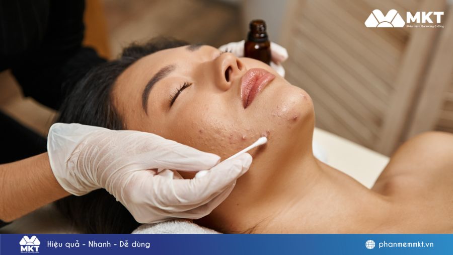 Status hay về trị mụn cho Spa Content trị mụn: Bộ công thức hút khách cho spa