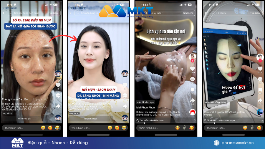 Kinh nghiệm marketing online cho spa mới mở không thể bỏ qua
